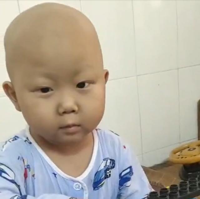 化疗见效慢，广西夫妻带孩子做针灸，结果却不尽人意