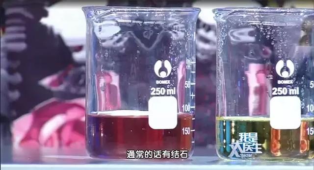 尿检查vc11是什么意思