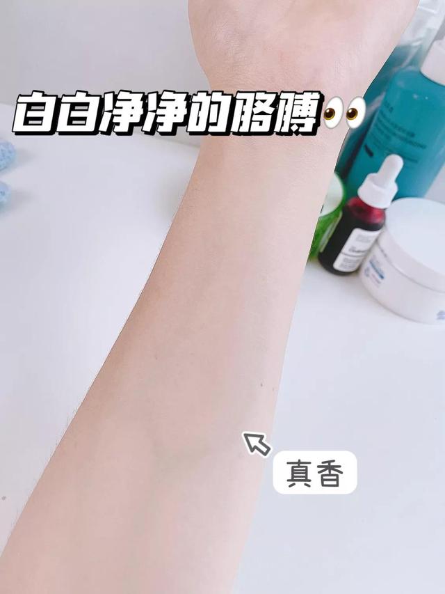 芦荟胶涂腿上可以去鸡皮疙瘩吗