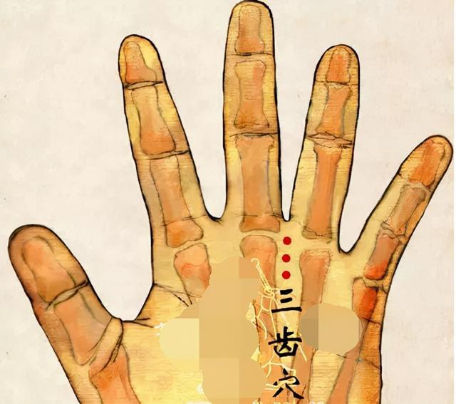 中医针灸口腔、牙齿疾病处方1