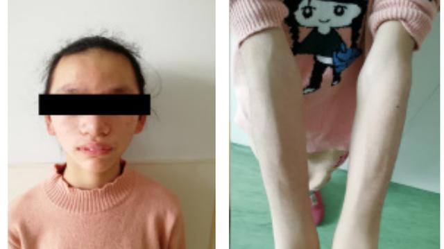 护士们都围过来，没见过刚满月的孩子长成网红脸