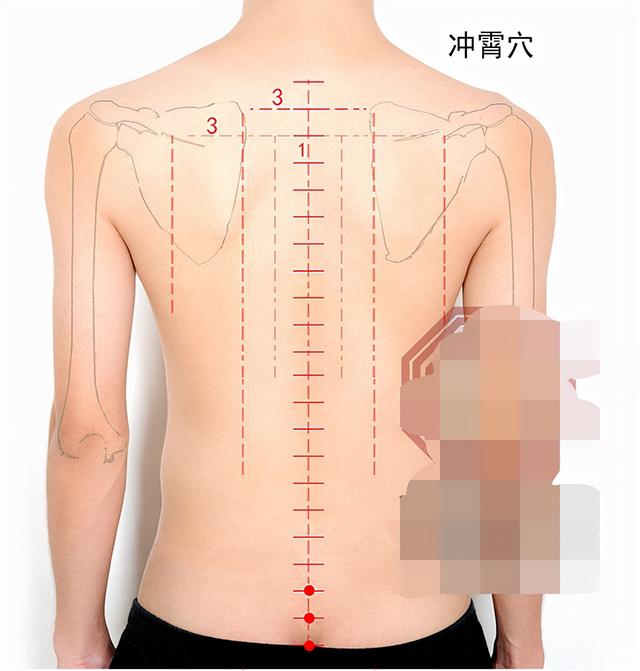 中医针灸颈部疾病处方2