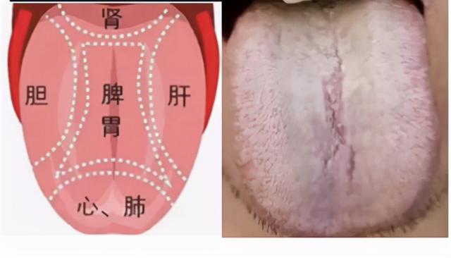 中医教你看舌诊，这几种情况要注意