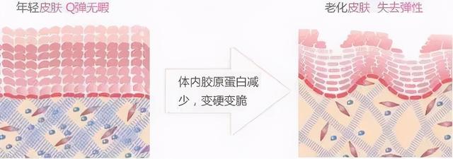 水杨酸引起皮肤角化异常