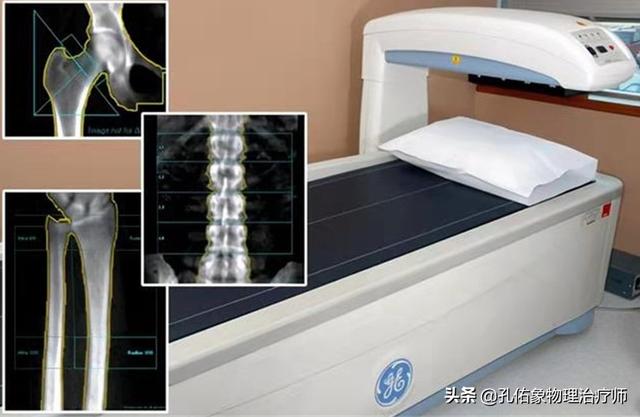 肩胛骨疼痛、手麻、整天头昏脑胀，是更年期综合症吗？不要被糊弄
