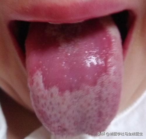 头颈大汗淋漓，动辄汗出，三点原因，医生三个方法都教给你