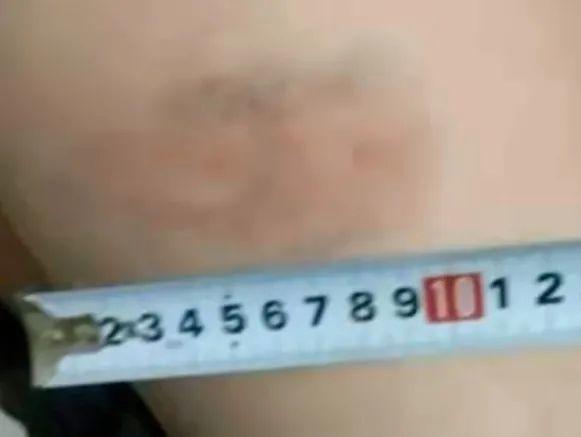 严厉的舞蹈老师用棍子打人(舞蹈生被严厉的老师打)