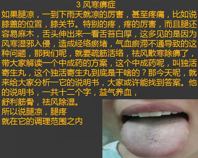 总是腿凉、腿寒？明白这三点，不用早早穿秋裤