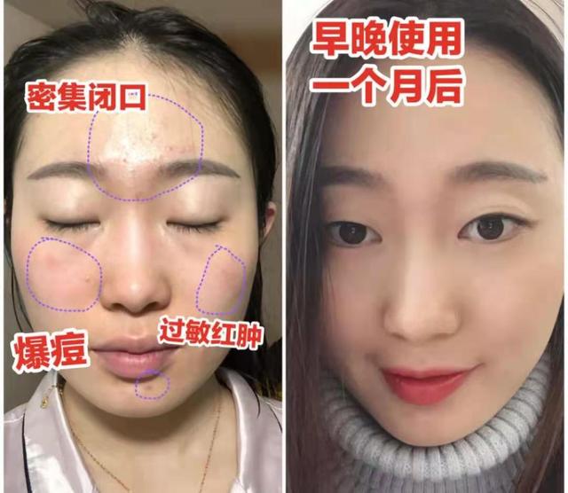 气垫怎么换替换装