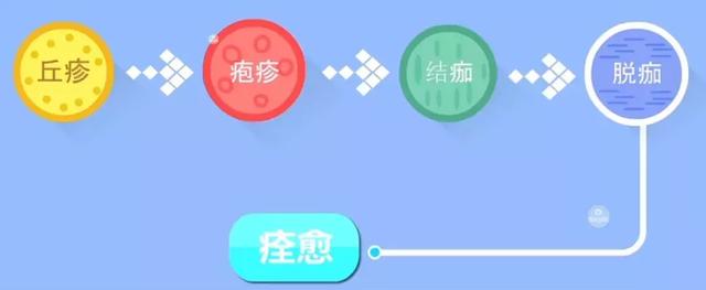 水痘的7天演变过程图片水痘图片