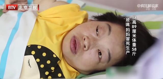 身高89厘米，体重58斤，“玻璃”妈妈冒死生下女儿！纪录片