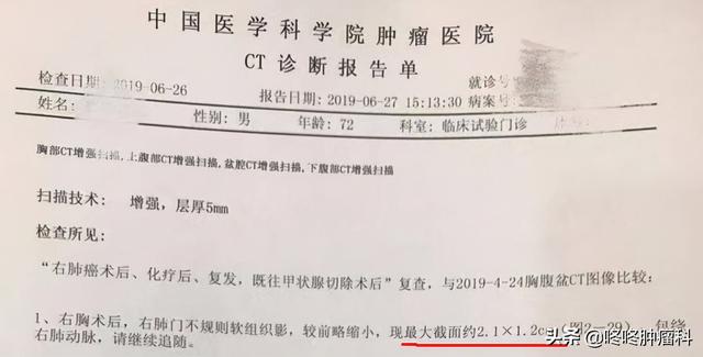 驚心動魄4年抗癌史：歷經40次PD-1治療，他正向臨床治愈目標挺進