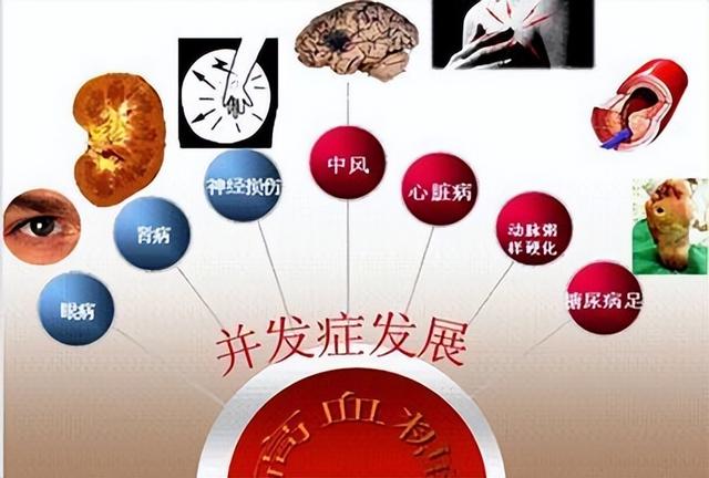得了糖尿病，“六忌”或许不能忘！坚持一个月，血糖或许会平稳