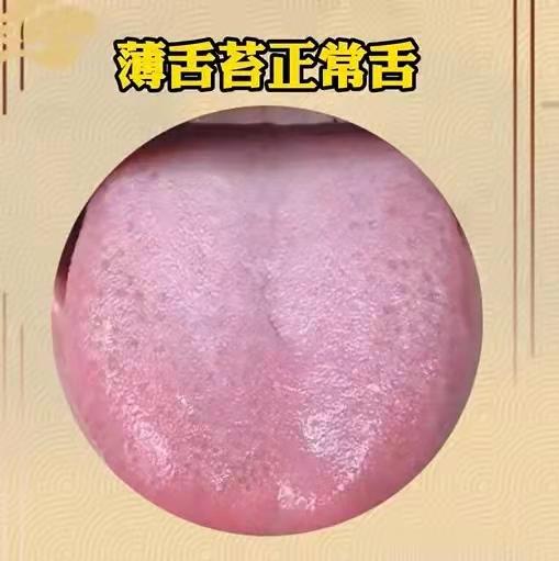 舌象分析，看看正常的和异常的舌象对比