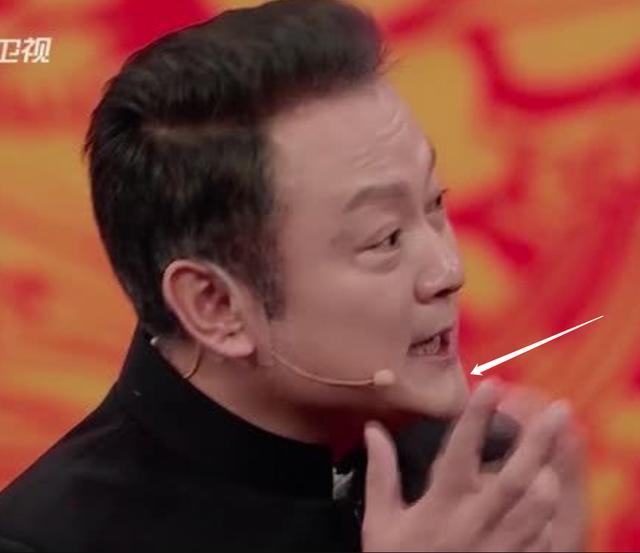 明星频翻车医美需谨慎！有人脸变充气气球，有人下巴变天气预报
