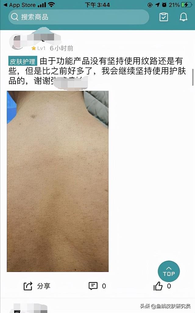 鱼鳞皮肤病奇痒怎么办