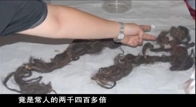 38岁光绪突然驾崩，2008年专家验出真实死因，凶手却暗藏惊天玄机