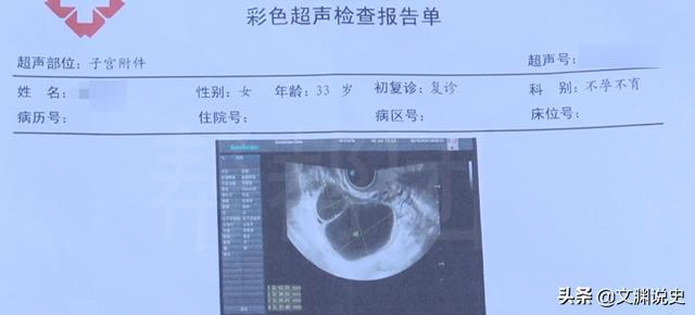 女性结扎3年了突然怀孕了（21年女子做完结扎手术）(2)
