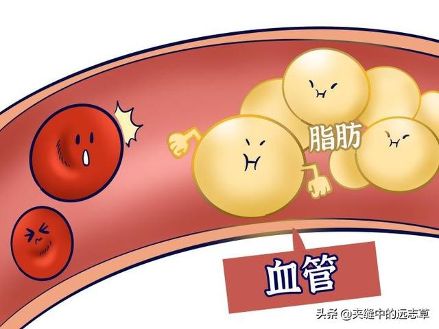 血脂高？多源于脾肾阳虚，送你六味中药，温脾肾、祛痰浊、化血瘀