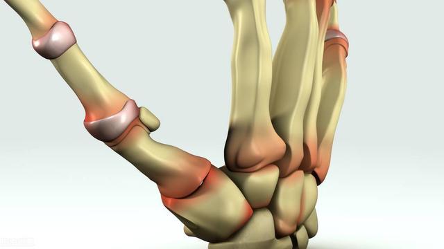 「医案」类风湿关节炎有哪些症状？中医如何调理？