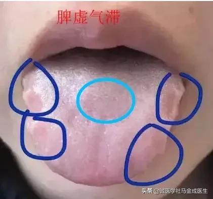 一吃凉的就胃痛？教你几个中成药，让你冷热酸甜，想吃就吃