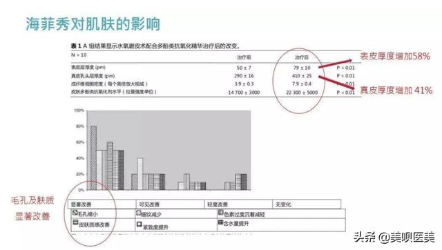医美无平替!4个小众贵妇级轻医美项目,谁做谁说值