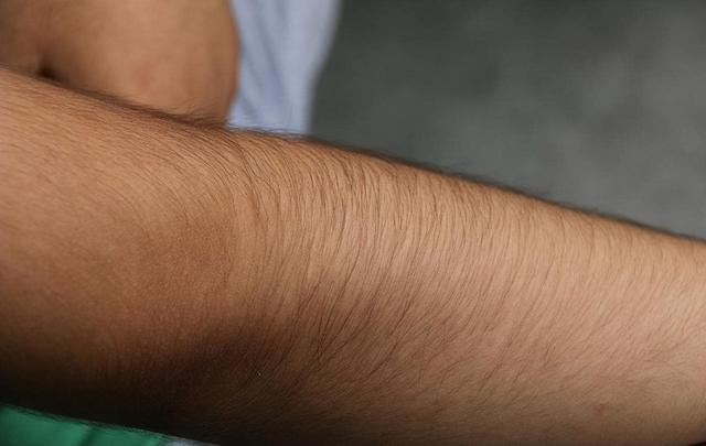 男人没有腿毛正常吗(男人为什么没腿毛)