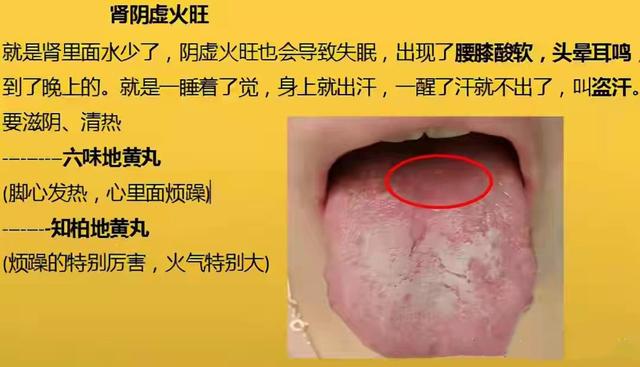 凌晨1—3点早醒，8种常见失眠类型，症状表现及实用中成药大总结