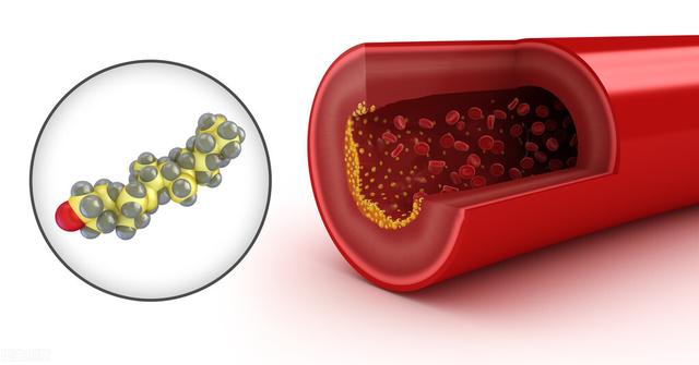 血管堵塞，中医有什么方法？