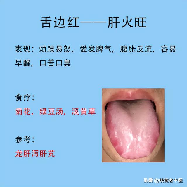 常见六种失眠的舌象，以及解决方法分享，这时候能睡个好觉了