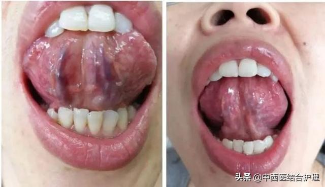 「舌诊科普」中医医生总看舌头都在看什么？奉上珍贵的舌诊图谱