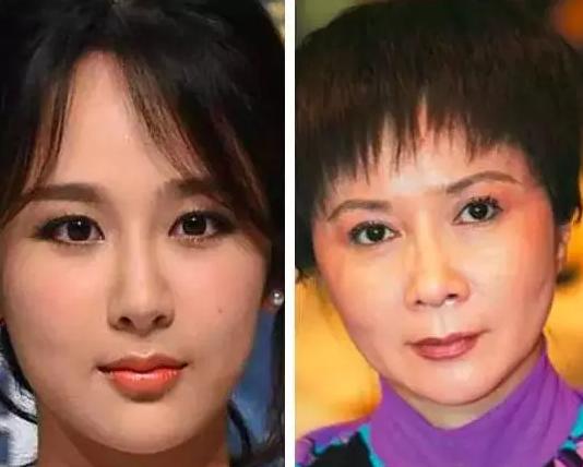 3月才开始，10位明星接连被曝“脸崩”，让61岁的蔡明情何以堪？