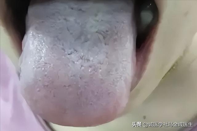 湿热、痰湿、寒湿如何区分？常见的表现是什么？哪些中药可以参考