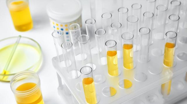 2个中成药，降糖、降尿蛋白、抑制肾损伤，辅助治疗糖尿病肾病