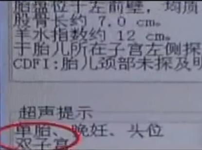 山东一产妇刚生孩子，一个月后又要临产，医生：从未见过这种情况