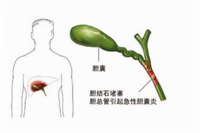 爱吃肉的人和爱吃素的人，哪个更长寿？科学研究告诉你答案