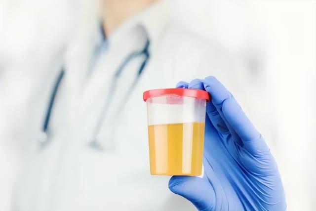 喝水后多久排尿说明肾脏很健康？医生：结合尿量判断更可靠
