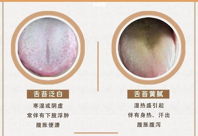 神奇的一方多治，高血压、脑中风、半身不遂均有疗效！值得一看