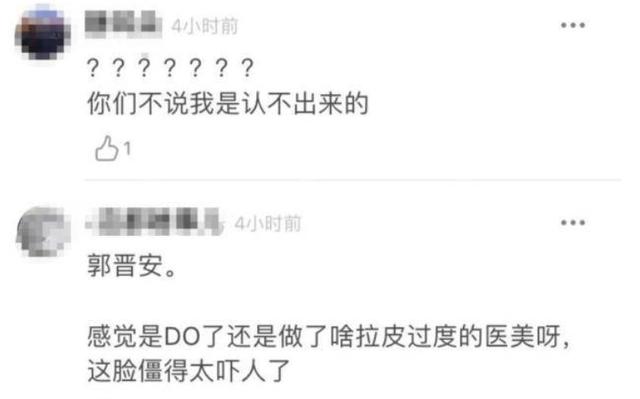 明星频翻车医美需谨慎！有人脸变充气气球，有人下巴变天气预报