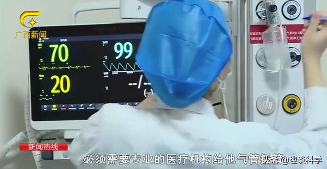 扔石头惹怒眼镜王蛇！七旬老伯被追咬，两招捡回一命，医生：万幸