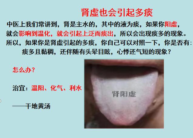 嗓子里总有痰，痰多吐不完？3个小方法，教你切断生痰之源