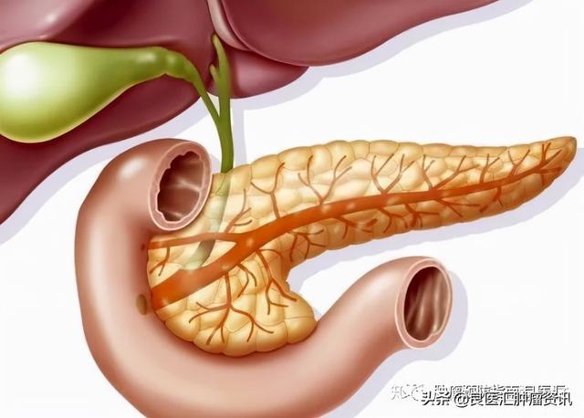 多位名人因胰腺癌去世，我們如何防備該疾病出其不意“來敲門”？