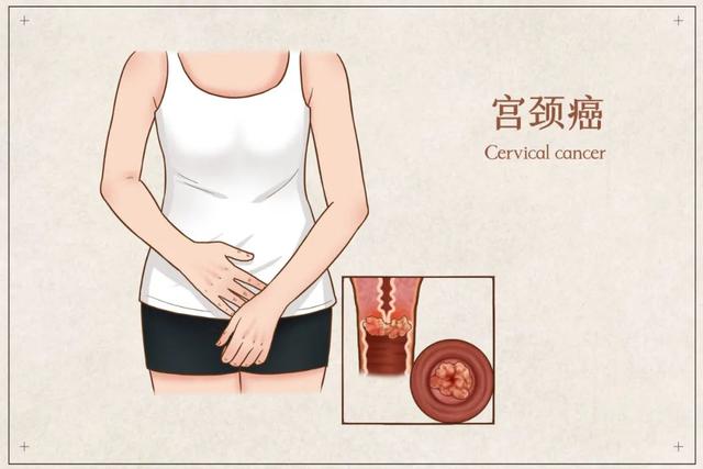 一查就晚期？其實身體早已發出預警