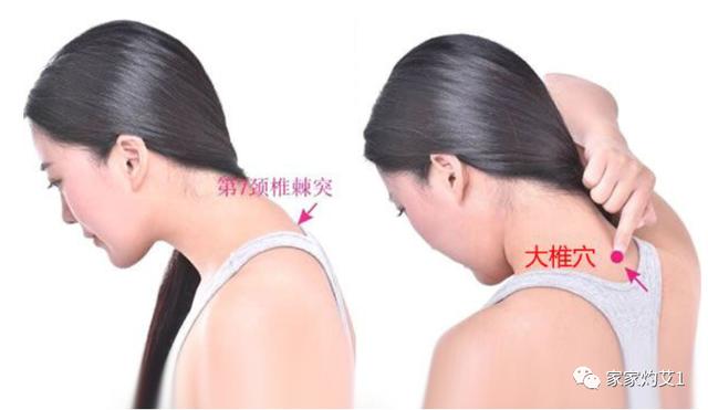 春季爱过敏？艾灸5穴拯救过敏体质，大人孩子都适用