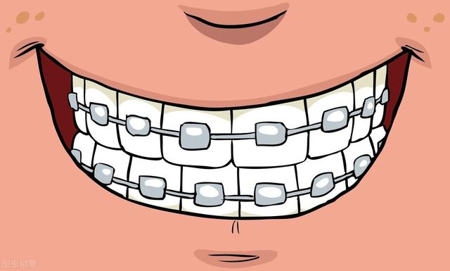 牙齿矫正居然有副作用 太可怕了 全网搜