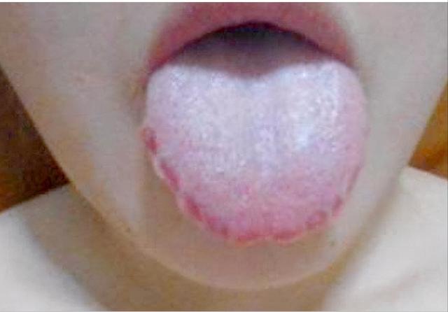 痰湿重、身体困倦、脾胃失调？试试这些方法，助你健脾祛湿