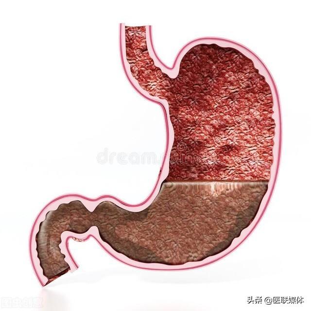 吃大蒜能养胃？做好这3件事，胃会慢慢变好
