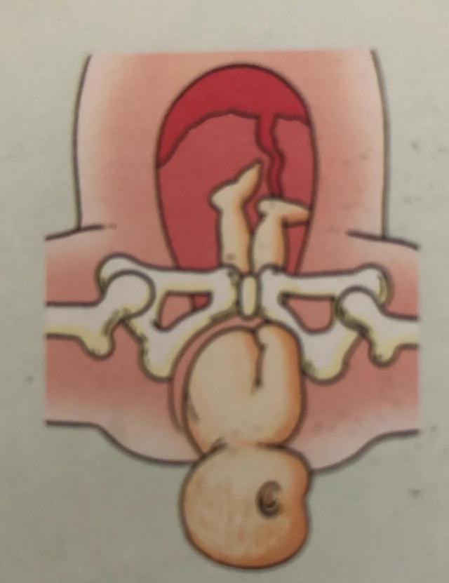 广东新增育儿假，老公叫我生三胎，我让他看完这6张图