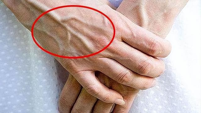 手臂上的青筋为什么会出现,有人手臂"青筋暴起"是怎么回事