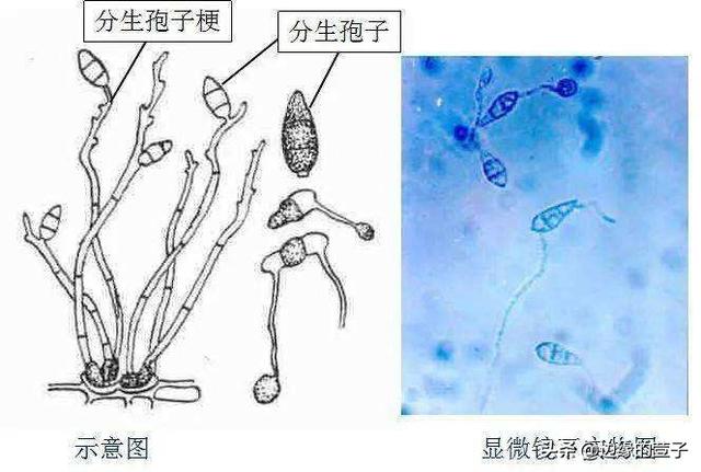 2022年2月，稻瘟病菌再现，没有硝烟的战争从未停止，谁干的？3